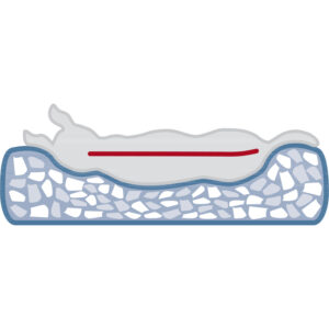 Cama Vital Calito - Imagen 6